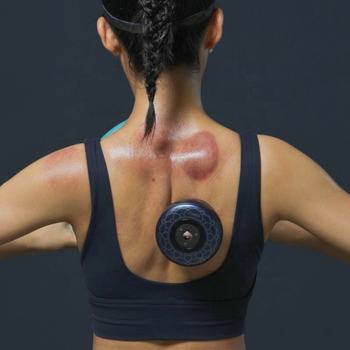 Electric Vacuum Cupping Massager-Smart Cupping Device